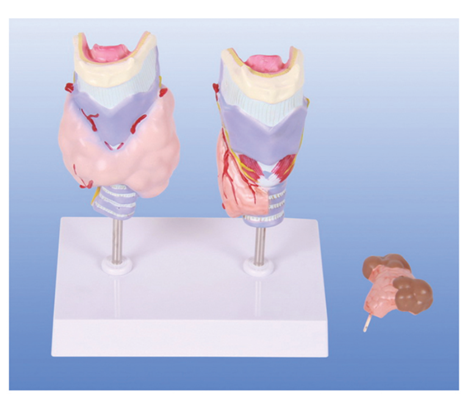 甲狀腺病理模型